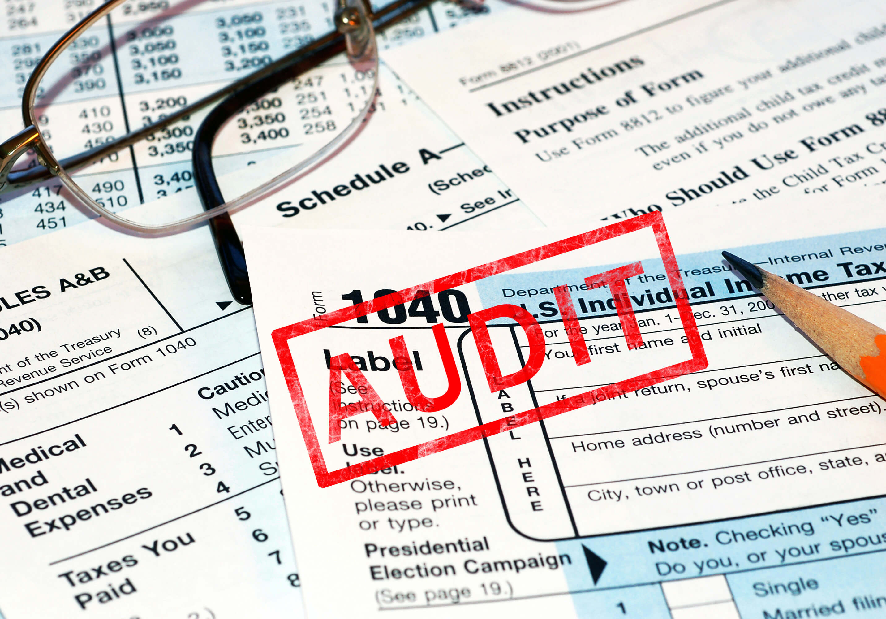 rights and options during irs audit